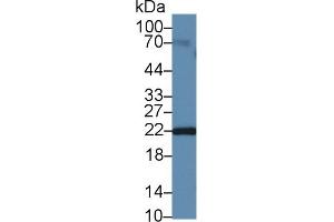 Western Blotting (WB) image for anti-Neurotensin (NTS) (AA 42-167) antibody (ABIN7433246)