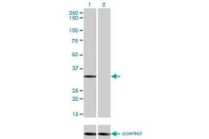 Western blot analysis of STK16 over-expressed 293 cell line, cotransfected with STK16 Validated Chimera RNAi (Lane 2) or non-transfected control (Lane 1). (STK16 抗体  (AA 1-305))