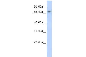 WB Suggested Anti-NCAPH2 Antibody Titration: 0. (NCAPH2 抗体  (N-Term))