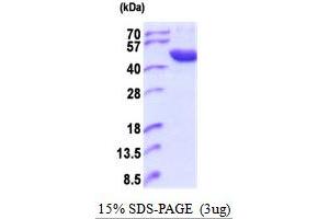 SDS-PAGE (SDS) image for Acid Phosphatase 6, Lysophosphatidic (ACP6) (AA 33-428) (Active) protein (His tag) (ABIN5854142) (ACP6 Protein (AA 33-428) (His tag))