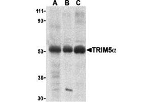 Western Blotting (WB) image for anti-Tripartite Motif Containing 5 (TRIM5) (Middle Region 1) antibody (ABIN1031194) (TRIM5 抗体  (Middle Region 1))