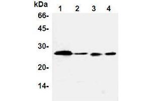 Western Blotting (WB) image for anti-B-Cell CLL/lymphoma 2 (BCL2) antibody (ABIN1105506) (Bcl-2 抗体)