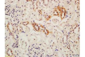 Formalin-fixed and paraffin embedded mouse kidney labeled with Rabbit Anti-ATG13 Polyclonal Antibody, Unconjugated  at 1:200 followed by conjugation to the secondary antibody and DAB staining (ATG13 抗体  (AA 51-150))