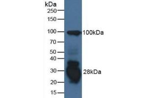 Detection of IFI30 in Human Raji Cells using Polyclonal Antibody to Interferon Gamma Inducible Protein 30 (IFI30) (IFI30 抗体  (AA 1-250))