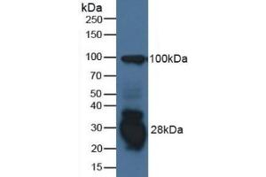 Detection of IFI30 in Human Raji Cells using Polyclonal Antibody to Interferon Gamma Inducible Protein 30 (IFI30)