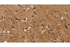 Immunohistochemistry of paraffin-embedded Human brain tissue using IL18R1 Polyclonal Antibody at dilution 1:40 (IL18R1 抗体)