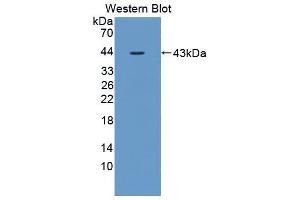 Western blot analysis of the recombinant protein. (IL12B 抗体  (AA 30-311))