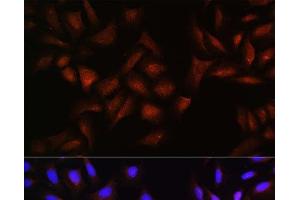 Immunofluorescence analysis of U-2 OS cells using BTRC Polyclonal Antibody at dilution of 1:100. (BTRC 抗体)