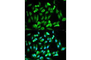 Immunofluorescence analysis of HeLa cells using ERG antibody (ABIN5970582). (ERG 抗体)