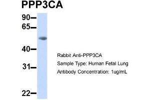 Host:  Rabbit  Target Name:  PPP3CA  Sample Type:  Human Fetal Lung  Antibody Dilution:  1. (PPP3CA 抗体  (Middle Region))