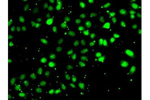 Immunofluorescence analysis of HeLa cells using NUDT2 antibody. (NUDT2 抗体)