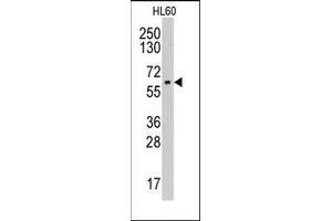 AP14030PU-N CYP19A1 antibody staining of HL60 cell line lysates by Western blot (35 µg/lane). (Aromatase 抗体  (Middle Region))