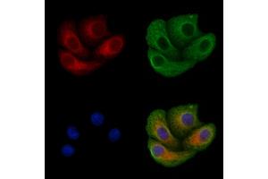 ABIN6257649 and ABIN6275602 staining Hela cells by IF/ICC. (Sorting Nexin 4 抗体  (Internal Region))