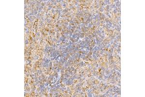 Immunohistochemistry (IHC) image for anti-TNF Receptor-Associated Factor 2 (TRAF2) (AA 1-300) antibody (ABIN3021165)