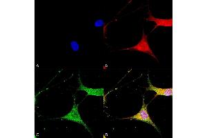 Immunocytochemistry (ICC) image for anti-Potassium Inwardly-Rectifying Channel, Subfamily J, Member 8 (KCNJ8) (AA 306-424) antibody (Atto 488) (ABIN6932453)
