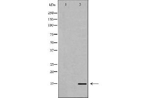 Western blot analysis of extracts of Mouse brain tissue lysate, using KISS1antibody. (KISS1 抗体  (Internal Region))