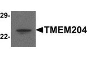 Western blot analysis of TMEM204 in human brain tissue lysate with TMEM204 antibody at 1 μg/ml. (TMEM204 抗体  (C-Term))