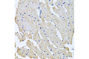 Immunohistochemistry of paraffin-embedded rat heart using GPLD1 antibody (ABIN5973975) at dilution of 1/100 (40x lens). (GPLD1 抗体)
