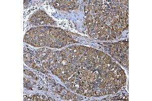 IHC analysis of FRY using anti-FRY antibody (ABIN7599716).