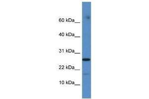 FAM36A antibody used at 1 ug/ml to detect target protein. (FAM36A 抗体  (Middle Region))