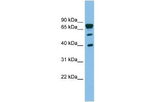 WB Suggested Anti-LETMD1 Antibody Titration: 0. (LETMD1 抗体  (Middle Region))