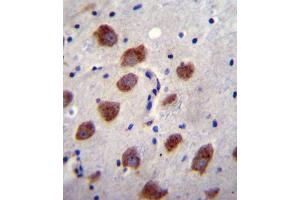 BR1B Antibody (Center) (ABIN655973 and ABIN2845358) immunohistochemistry analysis in formalin fixed and paraffin embedded human brain tissue followed by peroxidase conjugation of the secondary antibody and DAB staining. (BMPR1B 抗体  (AA 134-162))