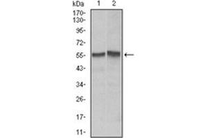 Western Blotting (WB) image for anti-TNF Receptor Superfamily, Member 6 (FAS) antibody (ABIN1106617) (FAS 抗体)