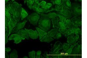 Immunofluorescence of monoclonal antibody to PTK7 on HeLa cell. (PTK7 抗体  (AA 36-145))