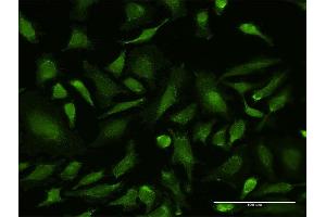 Immunofluorescence of monoclonal antibody to VDAC1 on HeLa cell.