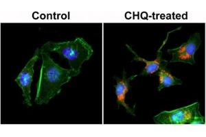 ICC staining of human HeLa cells untreated or treated with chloroquine (CHQ), with recombinant LC3B antibody (red) at 1:200 dilution. (Recombinant LC3B 抗体  (N-Term))