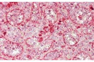 Detection of GUSb in Human Spleen Tissue using Polyclonal Antibody to Glucuronidase Beta (GUSb) (Glucuronidase beta 抗体  (AA 451-649))