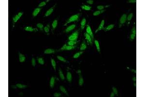 Immunofluorescence staining of Hela cells with ABIN7151937 at 1:100, counter-stained with DAPI. (ESRP2 抗体  (AA 615-720))