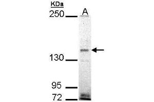WB Image Sample (30 ug of whole cell lysate) A: H1299 5% SDS PAGE antibody diluted at 1:1000 (EHBP1 抗体)