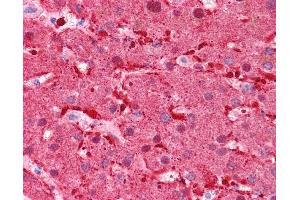 FABP1 antibody was used for immunohistochemistry at a concentration of 4-8 ug/ml. (FABP1 抗体  (N-Term))