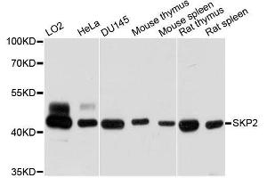 Western blot analysis of extracts of various cell lines, using SKP2 antibody. (SKP2 抗体  (AA 1-100))