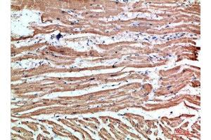 Immunohistochemical analysis of paraffin-embedded human-heart, antibody was diluted at 1:200 (NLRX1 抗体  (AA 581-630))