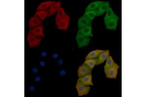 FAK Mouse Monoclonal Antibody staining Hela cells by IF/ICC. (FAK 抗体  (Internal Region))