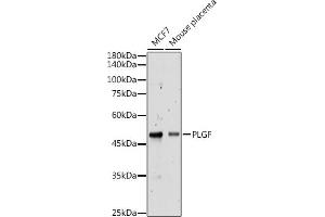 Western blot analysis of extracts of various cell lines, using PLGF antibody (ABIN7269385) at 1:500 dilution. (PLGF 抗体)