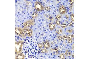 Immunohistochemistry of paraffin-embedded rat kidney using GIP antibody (ABIN5973668) at dilution of 1/100 (40x lens). (GIP 抗体)