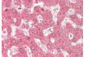 Rabbit Anti-DHODH antibody  Formalin Fixed Paraffin Embedded Tissue: Human Liver Primary antibody Concentration: 1:100 Secondary Antibody: Donkey anti-Rabbit-Cy3 Secondary Antibody Concentration: 1:200 Magnification: 20x Exposure Time: 0. (DHODH 抗体  (N-Term))