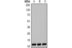 Western blot analysis of NPC2 expression in HEK293T (A), mouse lung (B), mouse liver (C) whole cell lysates. (NPC2 抗体)