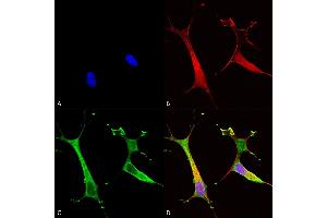 Immunocytochemistry/Immunofluorescence analysis using Mouse Anti-Copper Transporting ATPase 2 Monoclonal Antibody, Clone S62-29 (ABIN2485179). (ATP7B 抗体  (AA 3-21) (PE))