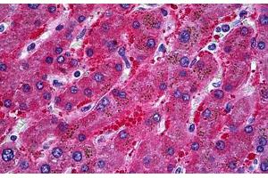Human Liver: Formalin-Fixed, Paraffin-Embedded (FFPE) (ALDH1L1 抗体  (AA 803-903))