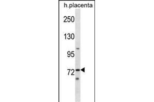 Mouse Sgk071 Antibody (N-term) (ABIN1539046 and ABIN2849427) western blot analysis in human placenta tissue lysates (35 μg/lane). (C9orf96 抗体  (N-Term))