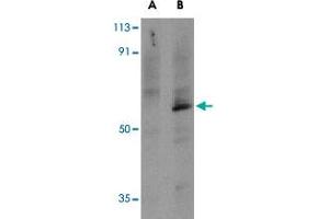 Western blot analysis of TRAF6 in PC-3 cell lysates with TRAF6 polyclonal antibody  at 1 ug/mL in the presence (A) or absence (B) of 1 ug blocking peptide. (TRAF6 抗体  (C-Term))