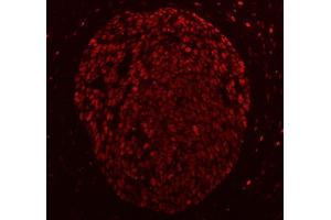 anti-Activated RNA Polymerase II Transcriptional Coactivator p15 (SUB1) (AA 62-127) antibody