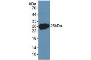 Western blot analysis of recombinant Human LIF. (LIF 抗体  (AA 2-201))