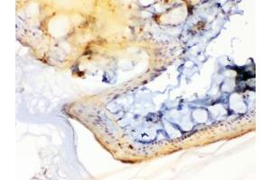 Immunohistochemistry (IHC) image for anti-Periplakin (PPL) (AA 1664-1701) antibody (ABIN5647242)