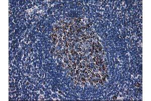 Image no. 5 for anti-Dihydrolipoamide Dehydrogenase (DLD) antibody (ABIN1497845) (DLD 抗体)