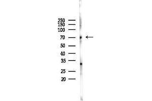 anti-Guanylate Cyclase 1, Soluble, beta 3 (GUCY1B3) (N-Term) antibody